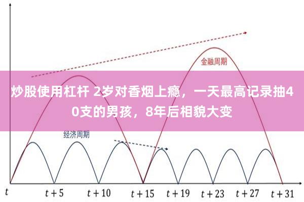 炒股使用杠杆 2岁对香烟上瘾，一天最高记录抽40支的男孩，8年后相貌大变